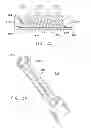Fig. 09 - Rotate-to-advance catheterization system