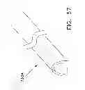 Fig. 37 - Rotate-to-advance catheterization system