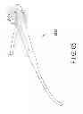 Fig. 44 - Rotate-to-advance catheterization system