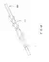 Fig. 47 - Rotate-to-advance catheterization system