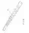 Fig. 52 - Rotate-to-advance catheterization system