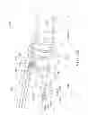 Fig. 67 - Rotate-to-advance catheterization system