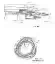Fig. 75 - Rotate-to-advance catheterization system