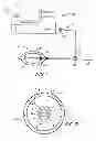 Fig. 02 - Nested balloon catheter for localized drug delivery