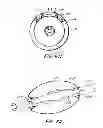 Fig. 07 - Nested balloon catheter for localized drug delivery