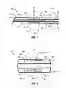 Fig. 02 - PASSIVE PRESSURE SENSOR FOR IMPLANTABLE LEAD