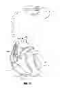 Fig. 08 - PASSIVE PRESSURE SENSOR FOR IMPLANTABLE LEAD