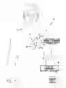 Fig. 02 - System and method for discriminating hypervolemia, hypervolemia and euvolemia using an implantable medical device
