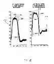 Fig. 07 - System and method for discriminating hypervolemia, hypervolemia and euvolemia using an implantable medical device