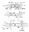 Fig. 06 - Methods for thermally-induced renal neuromodulation
