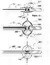 Fig. 08 - Methods for thermally-induced renal neuromodulation