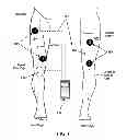 Fig. 02 - Apparatus and method for stabilizing, improving mobility, and controlling cartilage matrix degradation of weight-bearing articular joints