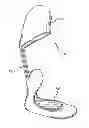Fig. 01 - Dynamic exoskeletal orthosis