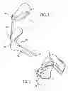 Fig. 02 - Dynamic exoskeletal orthosis