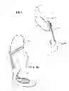 Fig. 04 - Dynamic exoskeletal orthosis
