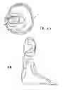 Fig. 05 - Dynamic exoskeletal orthosis