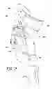 Fig. 10 - Dynamic exoskeletal orthosis
