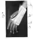 Fig. 07 - BANDAGES