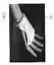 Fig. 08 - BANDAGES