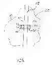 Fig. 02 - Fluid communication device and method of use thereof