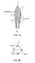 Fig. 22 - Device, system and methods for the oral delivery of therapeutic compounds