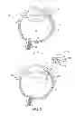 Fig. 02 - Fluid exchange apparatus and methods