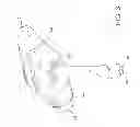 Fig. 04 - Base for an enteral feeding device