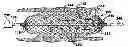 Fig. 01 - Method and apparatus for increasing blood flow through an obstructed blood vessel