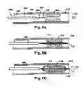 Fig. 03 - Method and apparatus for increasing blood flow through an obstructed blood vessel