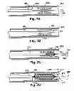 Fig. 04 - Method and apparatus for increasing blood flow through an obstructed blood vessel