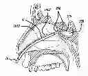 Fig. 01 - METHODS, DEVICES AND SYSTEMS FOR TREATING AND/OR DIAGNOSIS OF DISORDERS OF THE EAR, NOSE AND THROAT