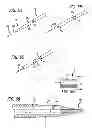 Fig. 06 - METHODS, DEVICES AND SYSTEMS FOR TREATING AND/OR DIAGNOSIS OF DISORDERS OF THE EAR, NOSE AND THROAT