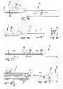 Fig. 08 - METHODS, DEVICES AND SYSTEMS FOR TREATING AND/OR DIAGNOSIS OF DISORDERS OF THE EAR, NOSE AND THROAT