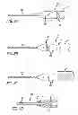 Fig. 09 - METHODS, DEVICES AND SYSTEMS FOR TREATING AND/OR DIAGNOSIS OF DISORDERS OF THE EAR, NOSE AND THROAT