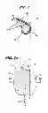 Fig. 03 - Fluid management device with fluid transport element for use within a body