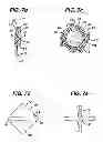 Fig. 08 - Fluid management device with fluid transport element for use within a body