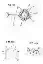 Fig. 10 - Fluid management device with fluid transport element for use within a body
