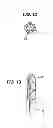 Fig. 11 - Fluid management device with fluid transport element for use within a body