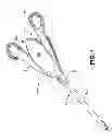 Fig. 02 - Surgical clip applier