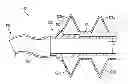 Fig. 01 - Devices and methods for occluding or promoting fluid flow
