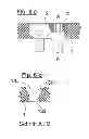 Fig. 07 - Bone plate system for osteosynthesis