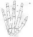 Fig. 01 - System and Method for Bone Fixation