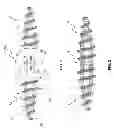 Fig. 02 - System and Method for Bone Fixation