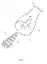 Fig. 03 - System and Method for Bone Fixation