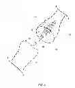 Fig. 06 - System and Method for Bone Fixation