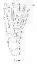 Fig. 16 - System and Method for Bone Fixation