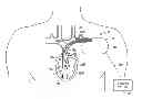 Fig. 01 - Managing cross therapy delivery in a multiple therapy implantable device