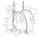Fig. 01 - System and method to modulate phrenic nerve to prevent sleep apnea