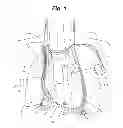 Fig. 02 - System and method to modulate phrenic nerve to prevent sleep apnea