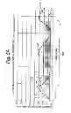 Fig. 05 - System and method to modulate phrenic nerve to prevent sleep apnea